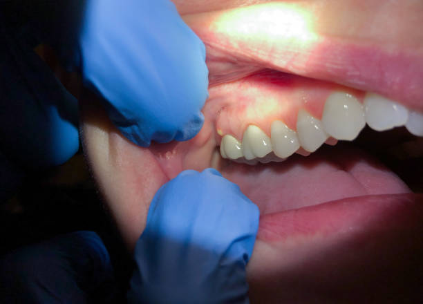 Best Emergency Treatment for Jaw Pain or Injury in Snyder, OK